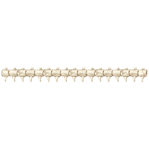 Spine Skeleton – Sprite Shape Profile